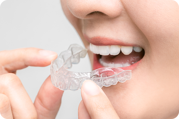 歯並びが気になる