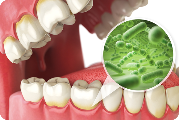 歯の病気を予防したい